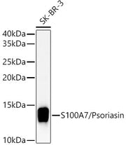 S100A7/Psoriasin Rabbit pAb