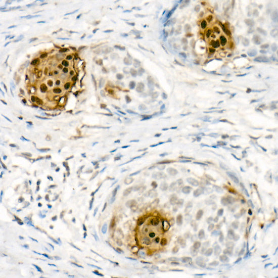 S100A7/Psoriasin Rabbit pAb