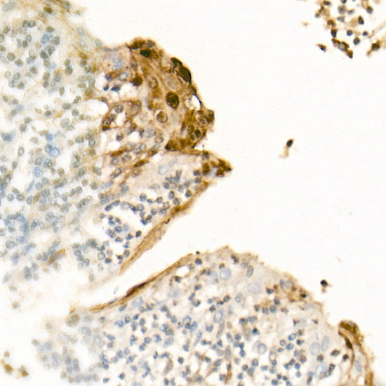 S100A7/Psoriasin Rabbit pAb