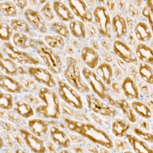 PDGFB Rabbit mAb
