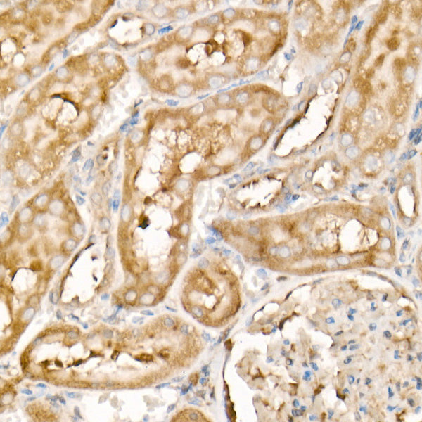 PDGFB Rabbit mAb
