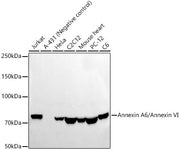 Annexin A6/Annexin VI Rabbit mAb