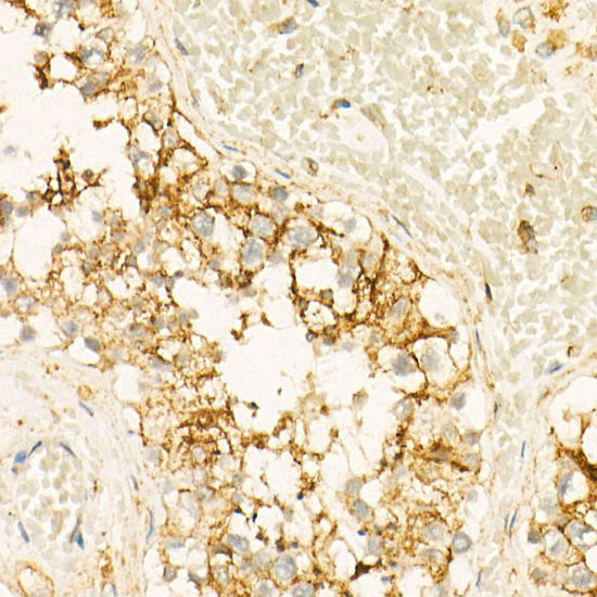 Annexin A6/Annexin VI Rabbit mAb