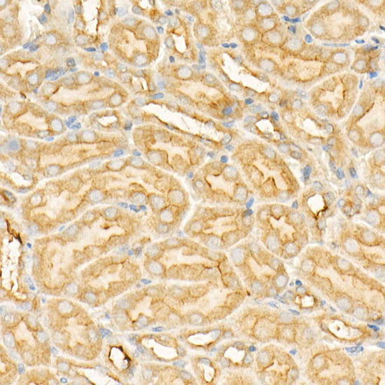 Annexin A6/Annexin VI Rabbit mAb