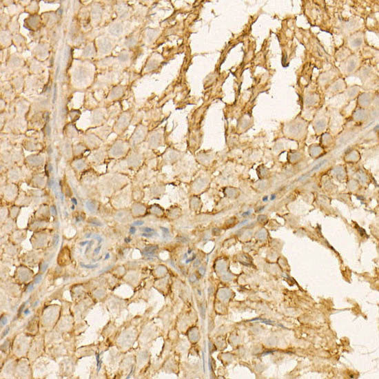 Annexin A6/Annexin VI Rabbit mAb