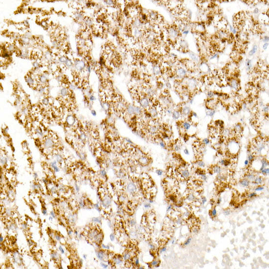 HAO1/GOX Rabbit mAb