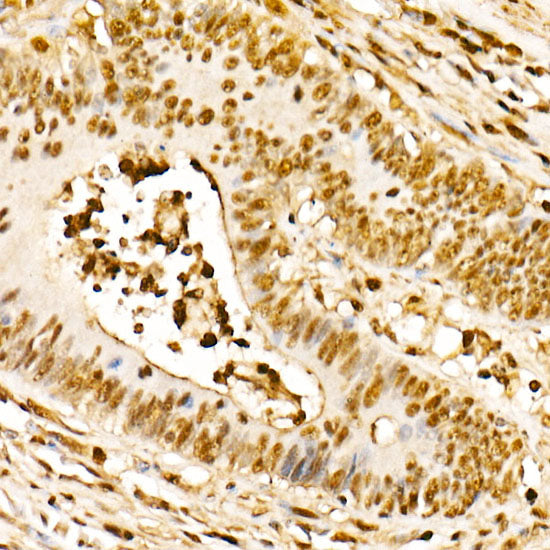 PBEF/Visfatin/NAMPT Rabbit mAb