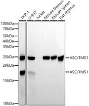 ASC/TMS1 Rabbit mAb