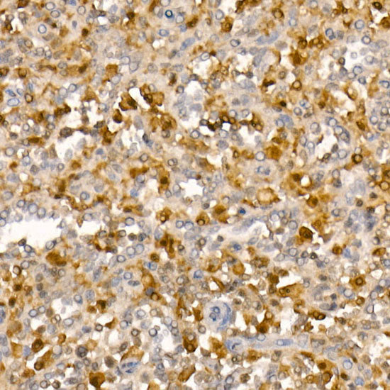 ASC/TMS1 Rabbit mAb