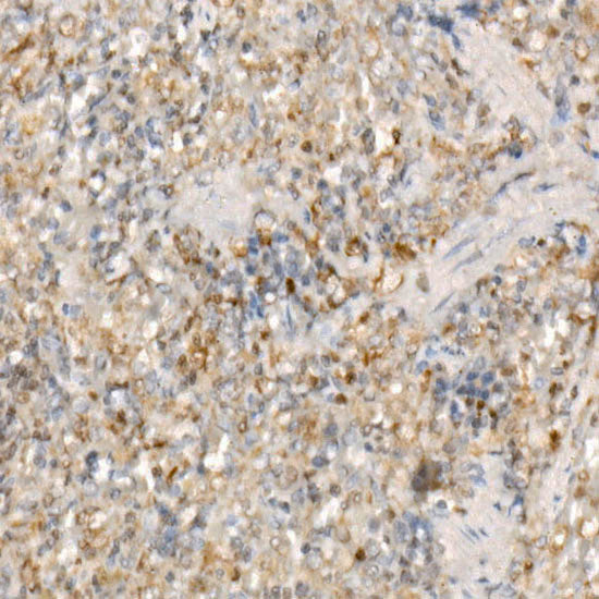 ASC/TMS1 Rabbit mAb