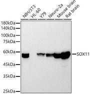 SOX11 Rabbit mAb