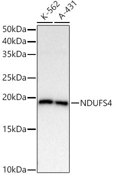 NDUFS4 Rabbit mAb
