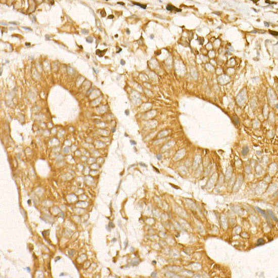 ADAM9 Rabbit mAb