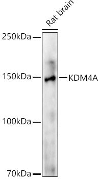 KDM4A Rabbit mAb