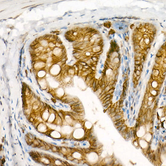 APC Rabbit mAb