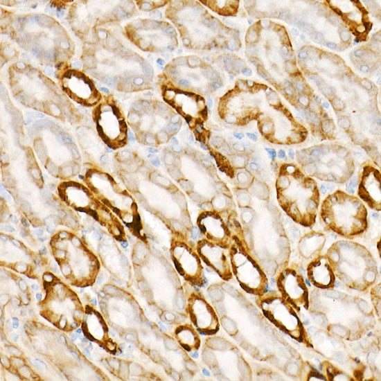APC Rabbit mAb