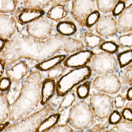 APC Rabbit mAb