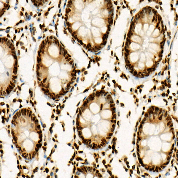 Acetyl-Histone H3-K27 Rabbit mAb