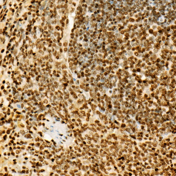 Acetyl-Histone H3-K27 Rabbit mAb