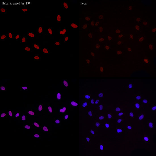 Acetyl-Histone H3-K27 Rabbit mAb