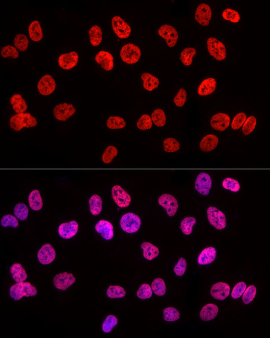 MonoMethyl-Histone H3-K4 Rabbit mAb