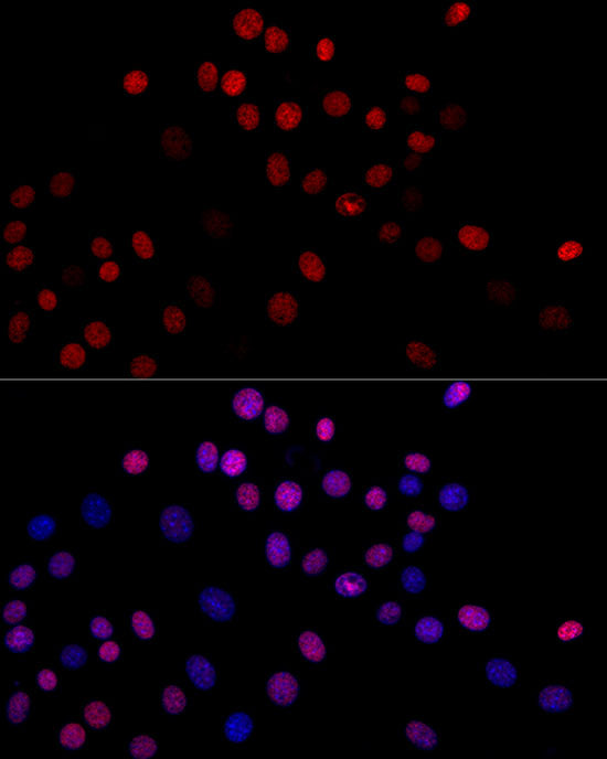 MonoMethyl-Histone H3-K4 Rabbit mAb