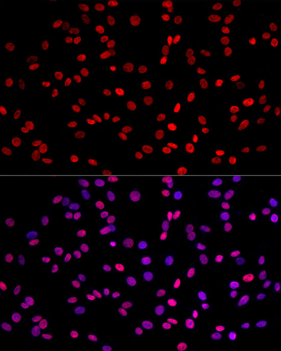 MonoMethyl-Histone H3-K4 Rabbit mAb