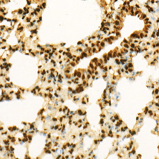 MonoMethyl-Histone H3-K9 Rabbit mAb