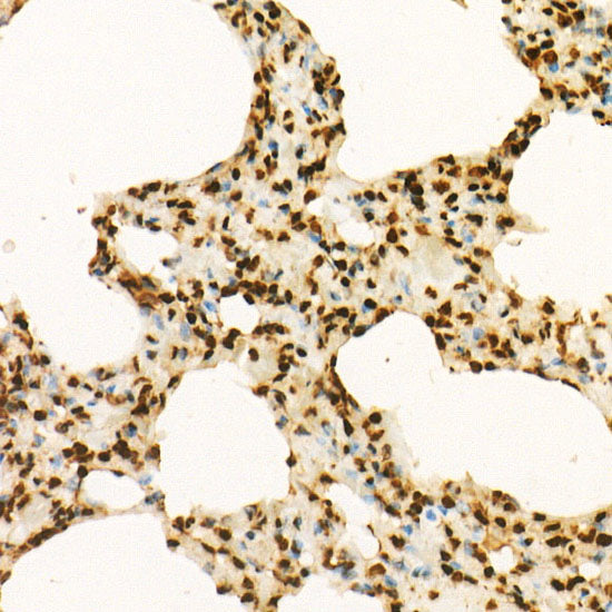 MonoMethyl-Histone H3-K9 Rabbit mAb