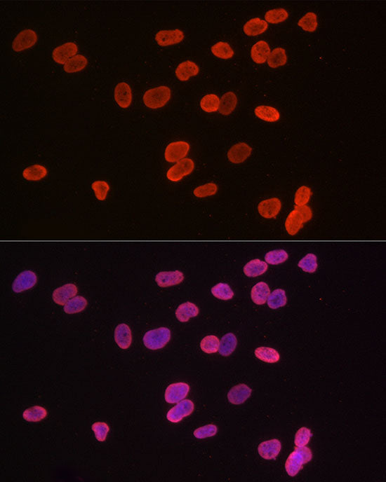 MonoMethyl-Histone H3-K9 Rabbit mAb
