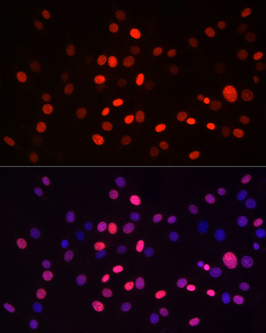 MonoMethyl-Histone H3-K9 Rabbit mAb