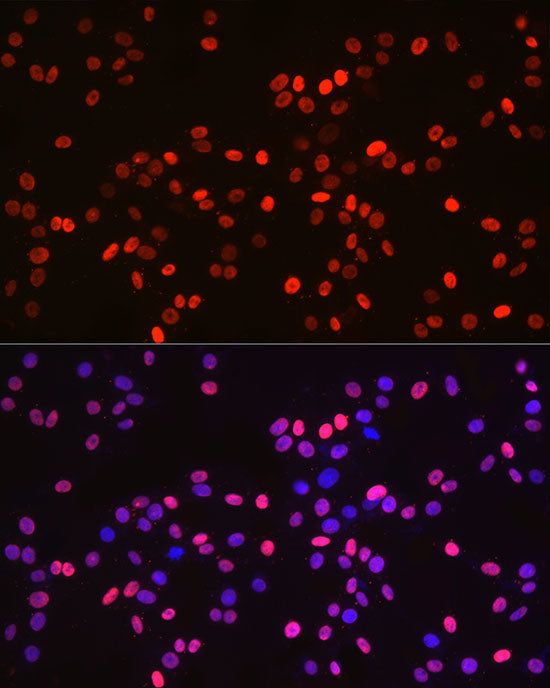MonoMethyl-Histone H3-K9 Rabbit mAb