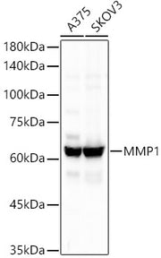 MMP1 Rabbit mAb