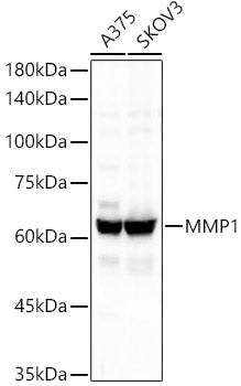 MMP1 Rabbit mAb
