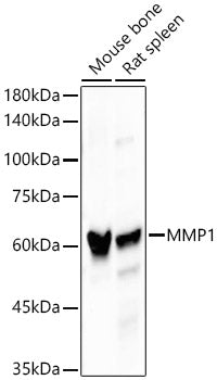 MMP1 Rabbit mAb