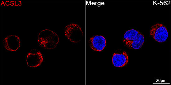 ACSL3 Rabbit mAb