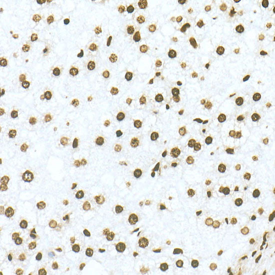 DiMethyl-Histone H3-K79 Rabbit mAb