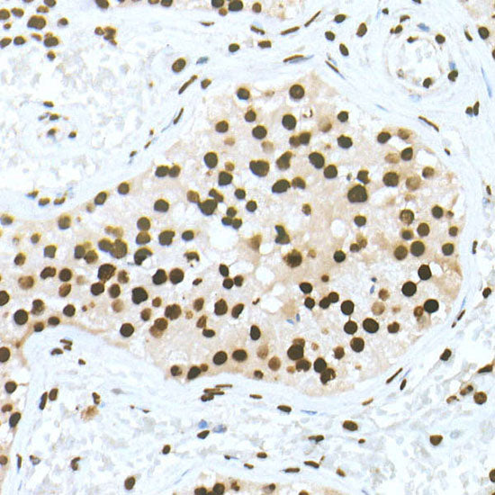DiMethyl-Histone H3-K79 Rabbit mAb