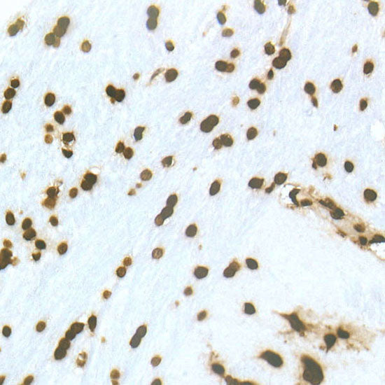 DiMethyl-Histone H3-K79 Rabbit mAb