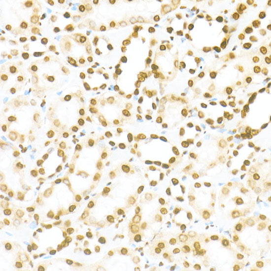 DiMethyl-Histone H3-K79 Rabbit mAb