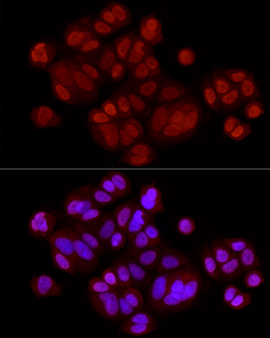 DiMethyl-Histone H3-K79 Rabbit mAb