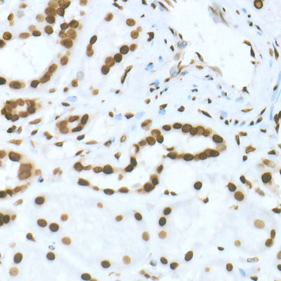 DiMethyl-Histone H3-K36 Rabbit mAb