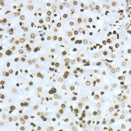 DiMethyl-Histone H3-K36 Rabbit mAb