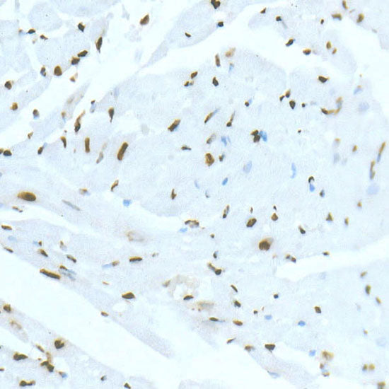 DiMethyl-Histone H3-K36 Rabbit mAb