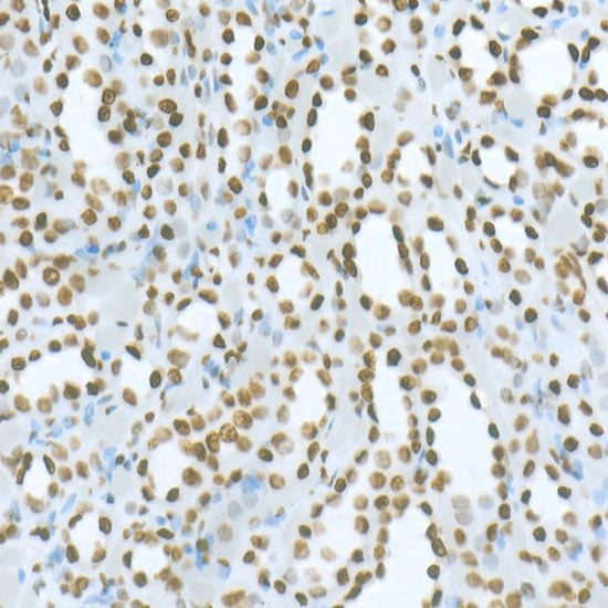 DiMethyl-Histone H3-K36 Rabbit mAb