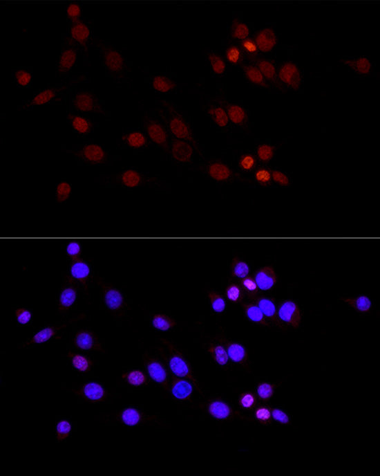 DiMethyl-Histone H3-K36 Rabbit mAb
