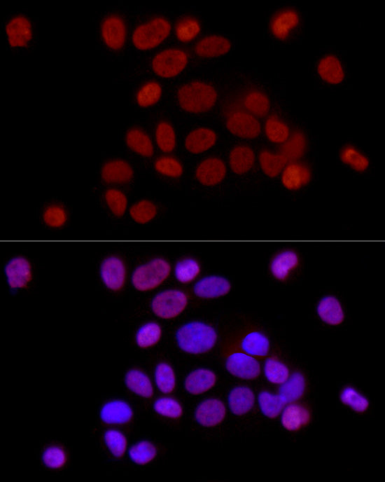 DiMethyl-Histone H3-K36 Rabbit mAb