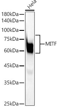 MITF Rabbit mAb