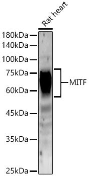 MITF Rabbit mAb