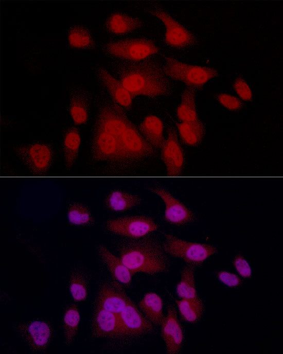 MITF Rabbit mAb